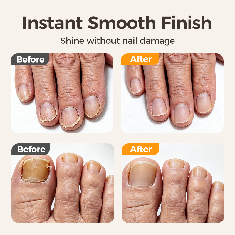 ✂️ LIMITED-TIME 50% OFF! 💅 2-in-1 Smart Electric Nail Clipper & Polisher 🌟