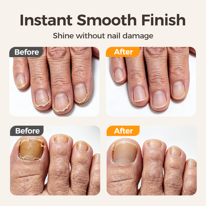 ✂️ LIMITED-TIME 50% OFF! 💅 2-in-1 Smart Electric Nail Clipper & Polisher 🌟