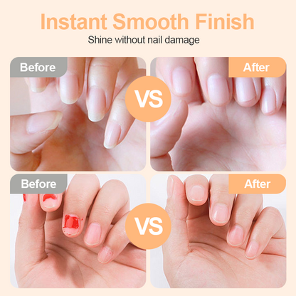 💅 TrimPro™ גוזז ציפורניים חשמלי 2-ב-1 ✨ | עצירה אוטומטית | LED מובנה | בטוח לתינוקות וקשישים 🛡️