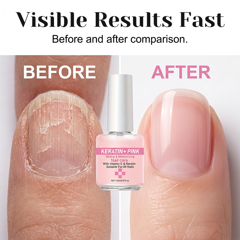 💅 טיפול ציפורניים עם קראטין | מחזק, מחליק ומבריק ✨ | 15מל לטיפול יומיומי 🌟